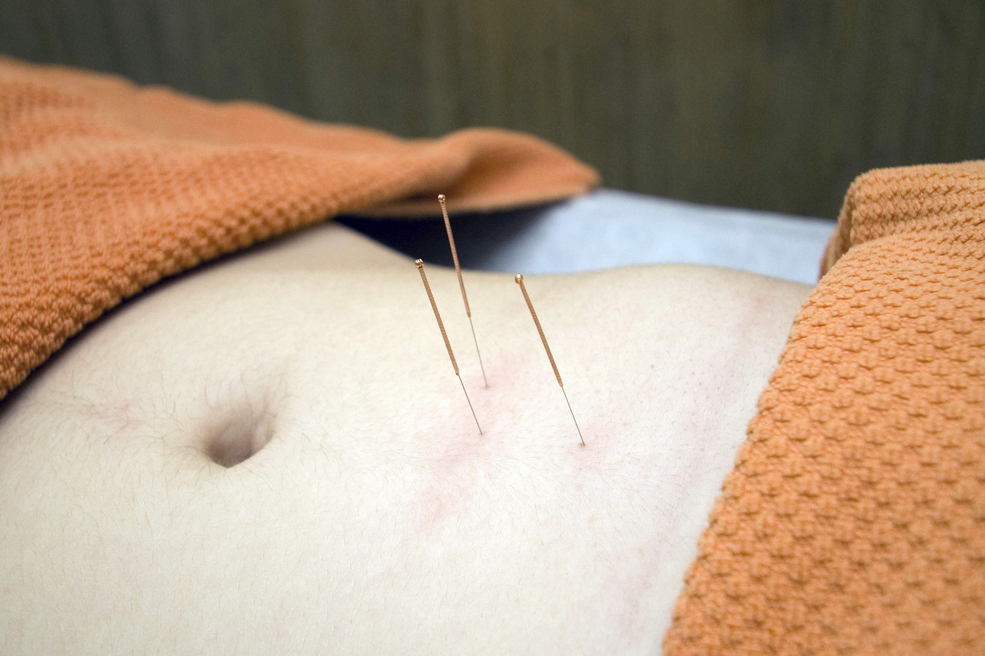 Acupuncture for fertility
